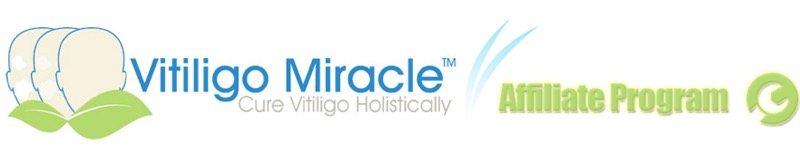 Vitiligo Miracle (TM) - VSL by 7 Figure Copywriter~ Phenomenal CVR vendor product image for this Everyrated magazine article
